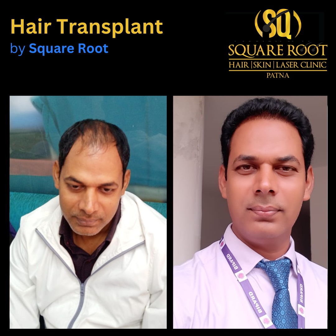 Square Root Clinic - Owner - Square Root - Hair, Skin